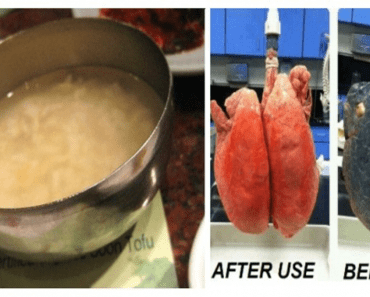 This Recipe Will Help Clear Your Lungs If You Have Been Smoking For More Than Five Years