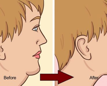 If You Have Double Chin Problems, You Can Do These Natural Things At Home…