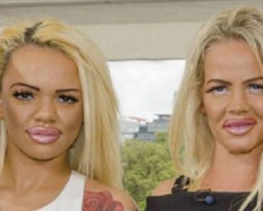 Mom And Daughter Spend Over $86,000 On Plastic Surgery, End Up Looking Like This