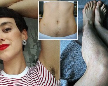 Woman, 28, Reveals She Hasn’t Shaved Body Hair For A Year