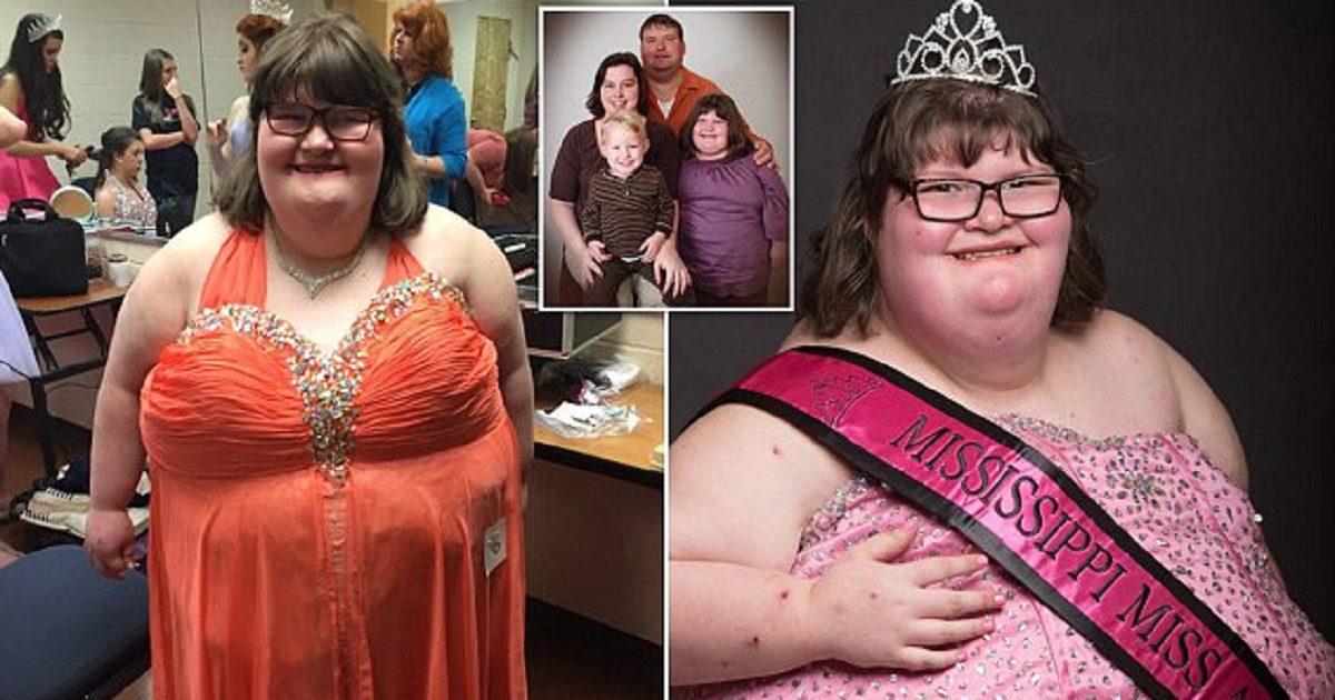 Obese Teenager Is So Hungry She Rifles Through Bins