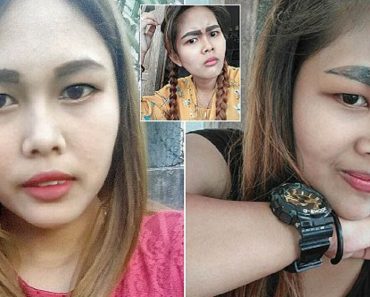 Woman, 26, Left With Huge Black Eyebrows After Botched Tattoo Fillers